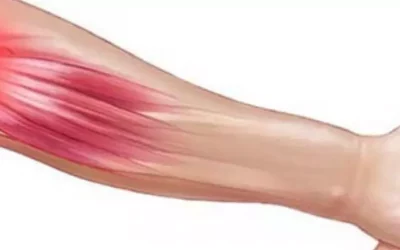 Dolor en el codo: por qué aparece y cómo solucionarlo sin dejar de usar el brazo