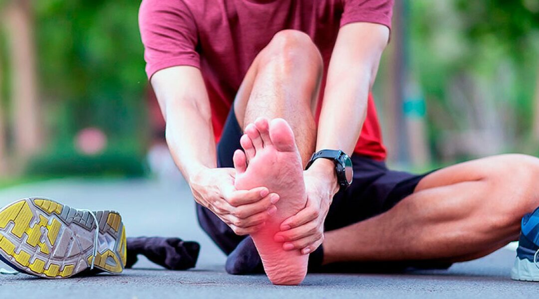 Fascitis plantar: por qué duele el talón y cómo volver a caminar o correr sin miedo