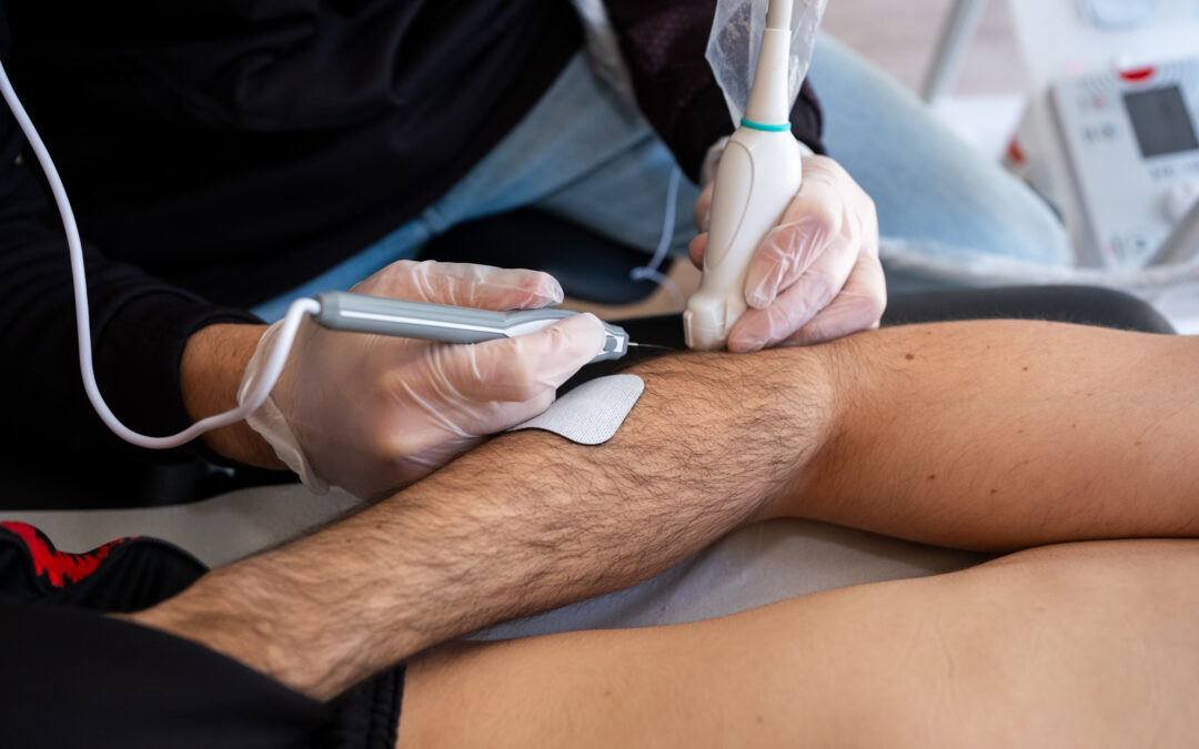 Tratamiento Electrolisis Percutánea (EPI) en Zaragoza